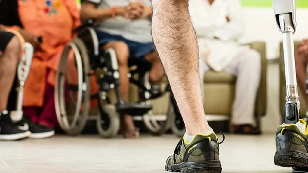 Bacak amputasyonu sonrası: Ayakta duran protez bacak kullanan kişi ve arkada rehabilitasyon grubu