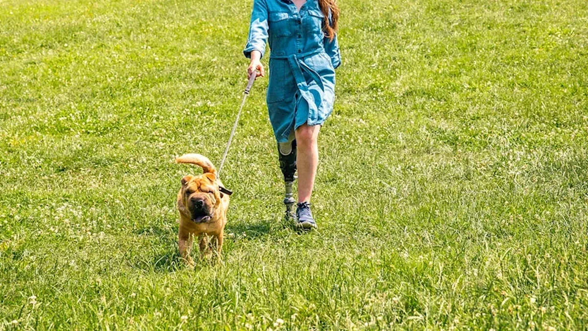 Çok amaçlı dinamik protez ayak: Köpeğiyle yokuş çıkan bacak protezli kişi